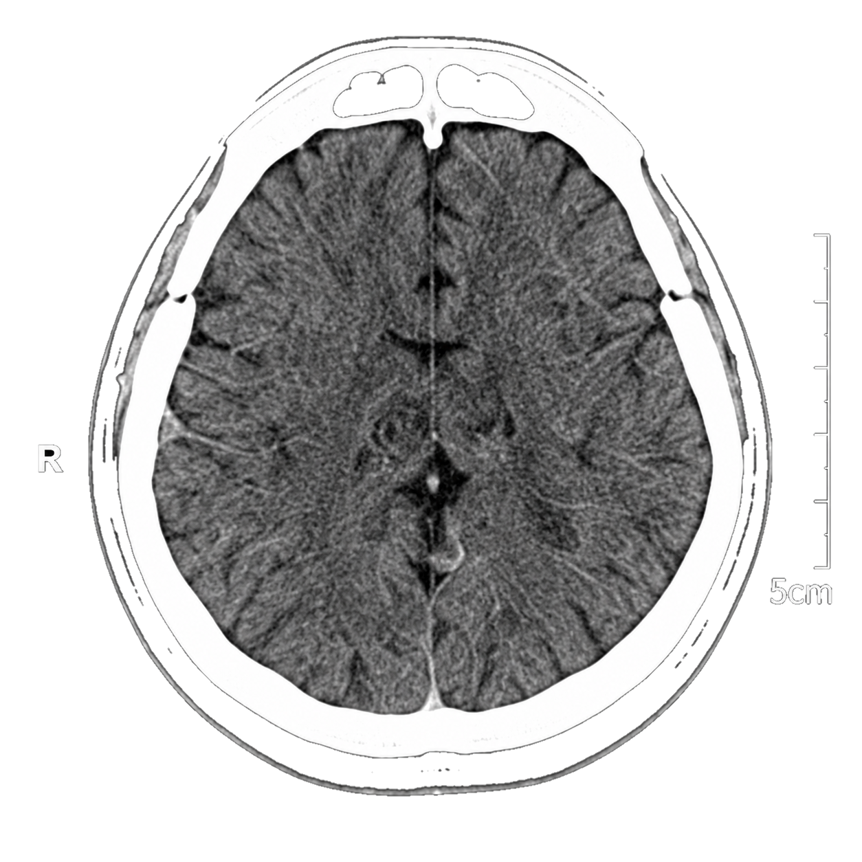 Brain scan